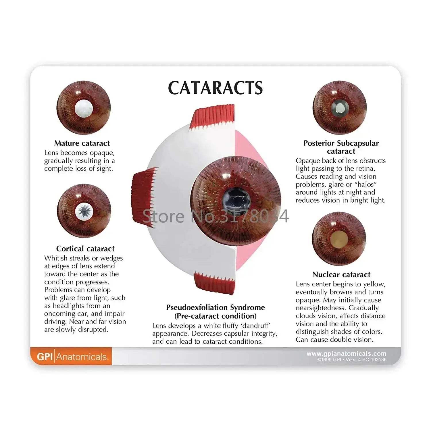 Human Eye Anatomical Model for Medical Education and Training - ToylandEU