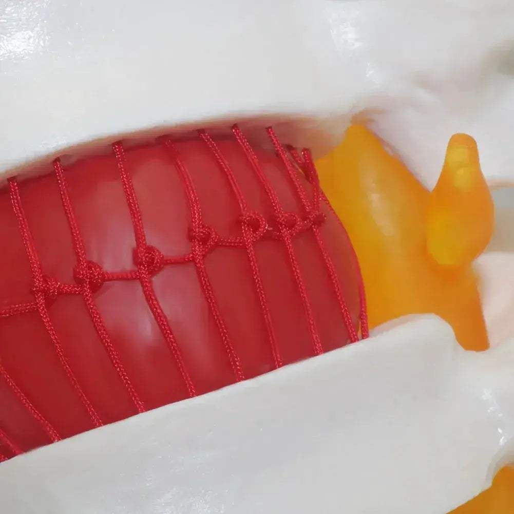 Intervertebral Disc Herniation Demonstration Model for Medical Teaching - ToylandEU