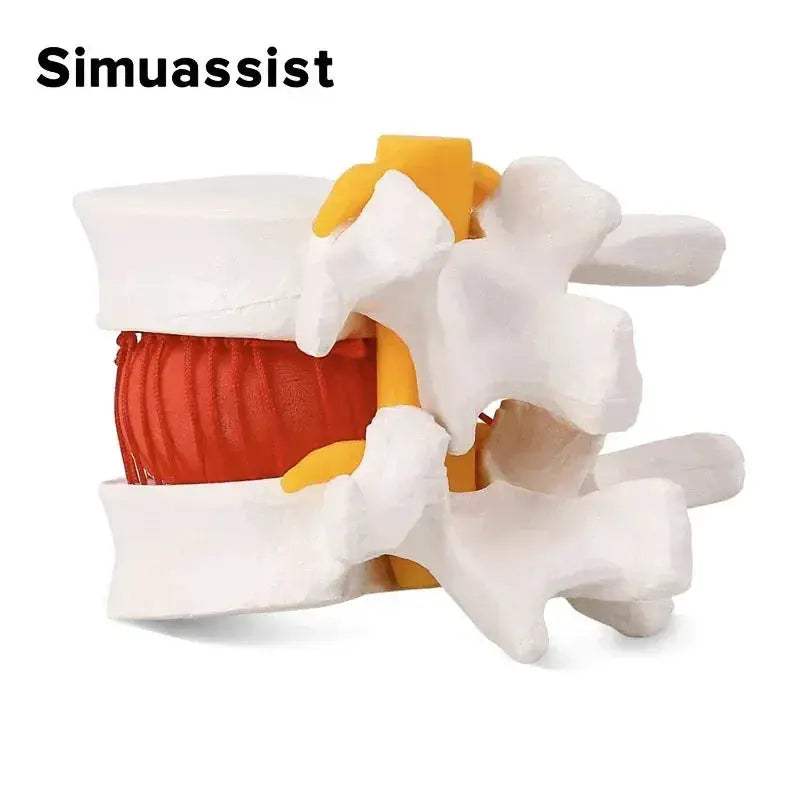 Lumbar Spine Disc Herniation Model For Realistic Medical Teaching - ToylandEU