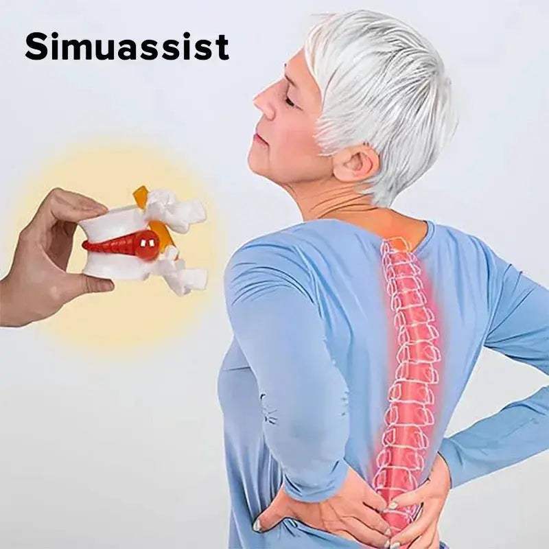 Lumbar Spine Disc Herniation Model For Realistic Medical Teaching - ToylandEU