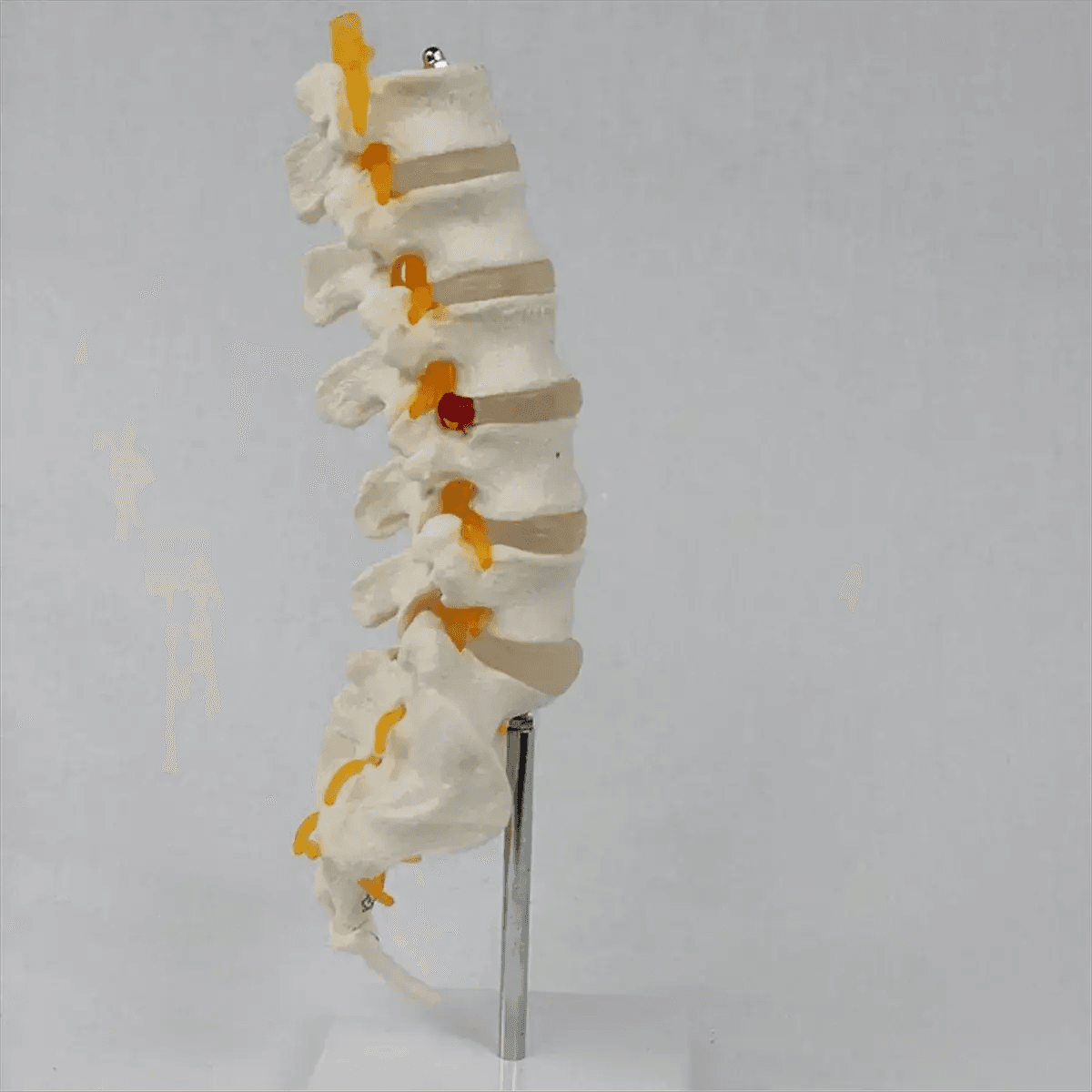 Lumbar Spine Model With Sacral Accessory Orthopedic Teaching - ToylandEU