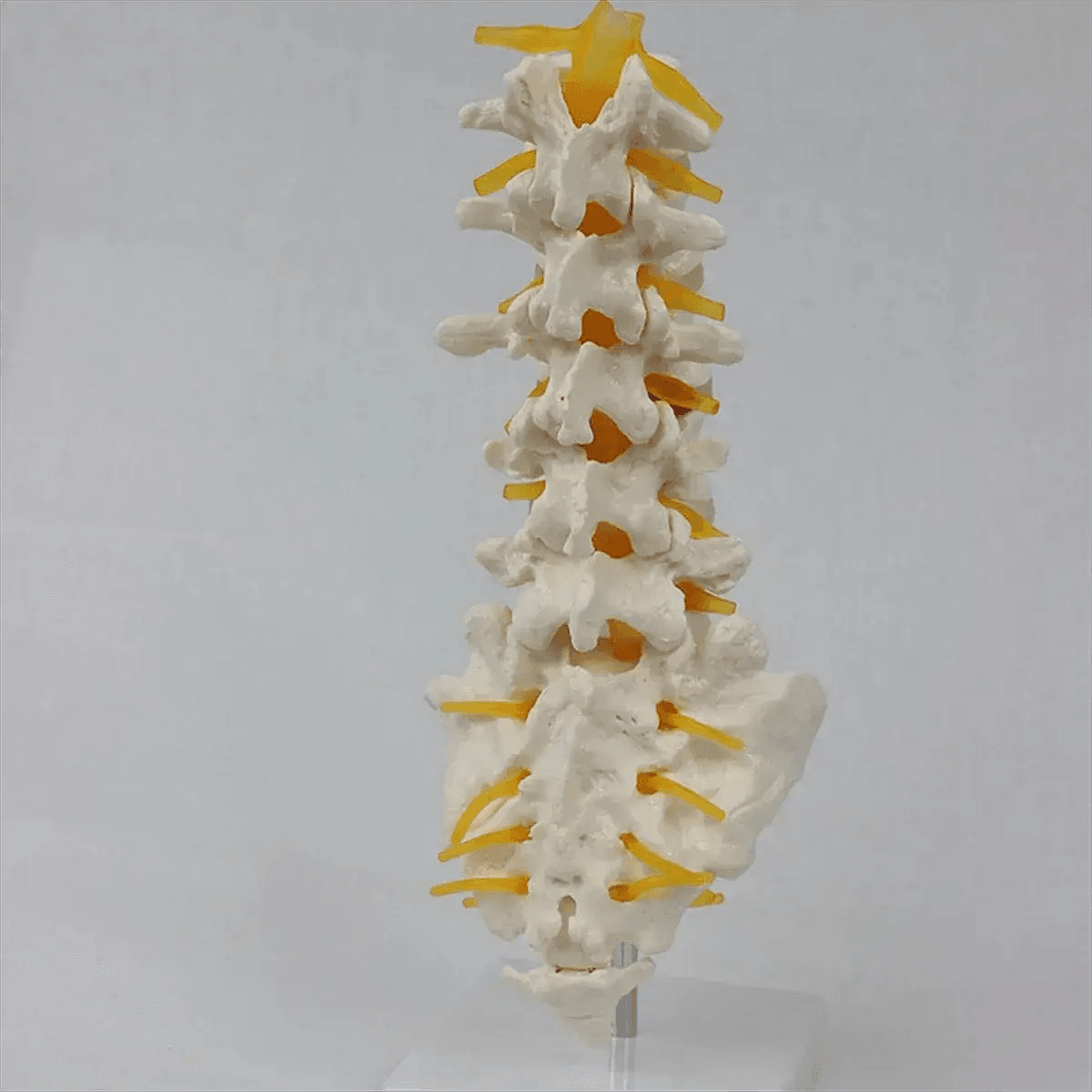 Lumbar Spine Model With Sacral Accessory Orthopedic Teaching - ToylandEU