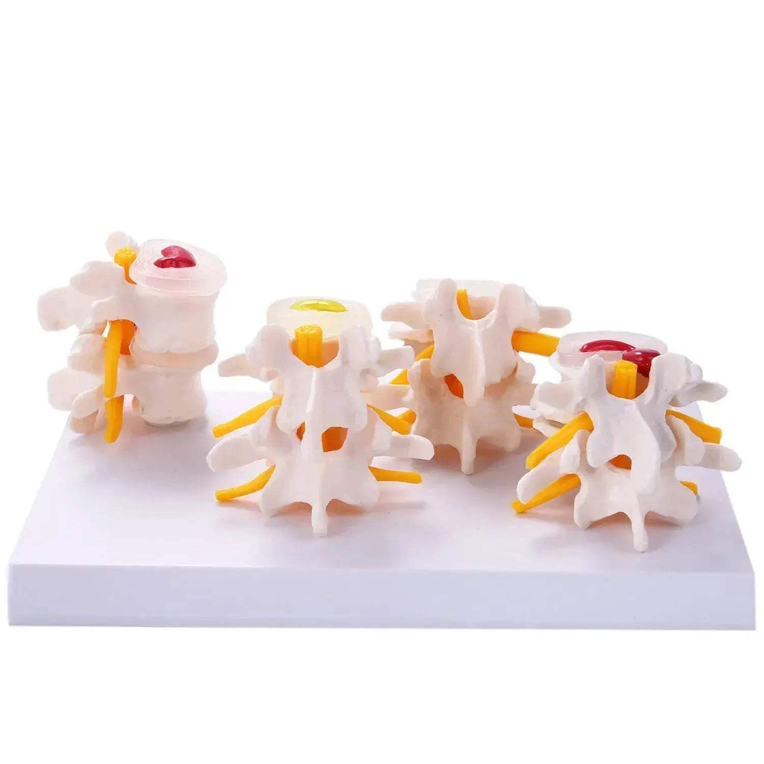 Lumbar Spine Vertebrae Model For Anatomy Education - ToylandEU