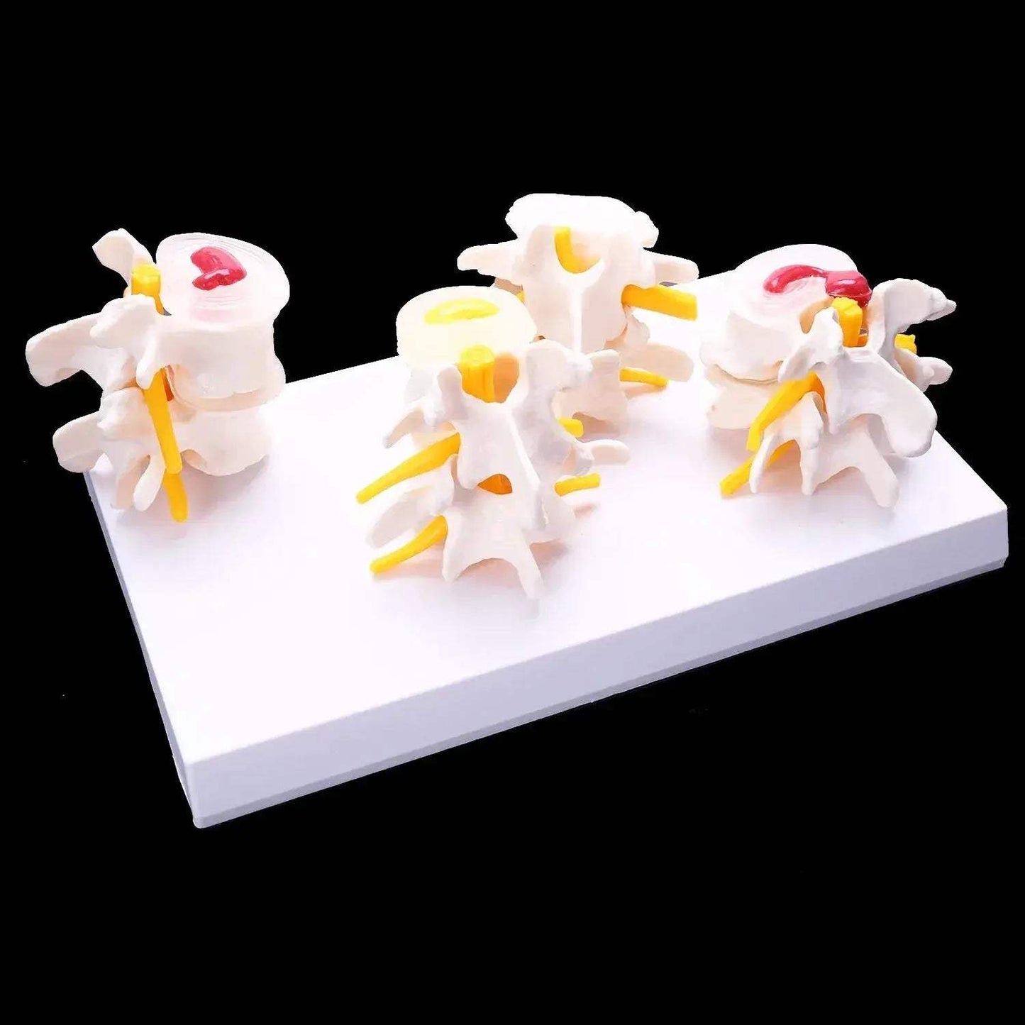 Lumbar Spine Vertebrae Model For Anatomy Education - ToylandEU