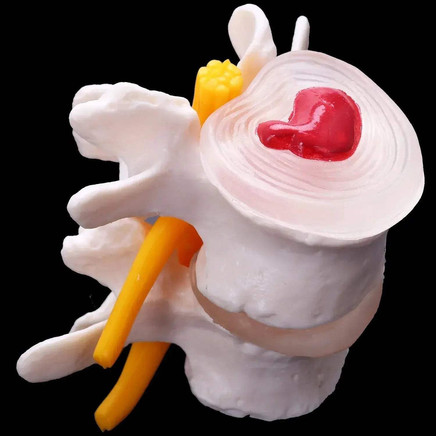 Lumbar Spine Vertebrae Model For Anatomy Education - ToylandEU
