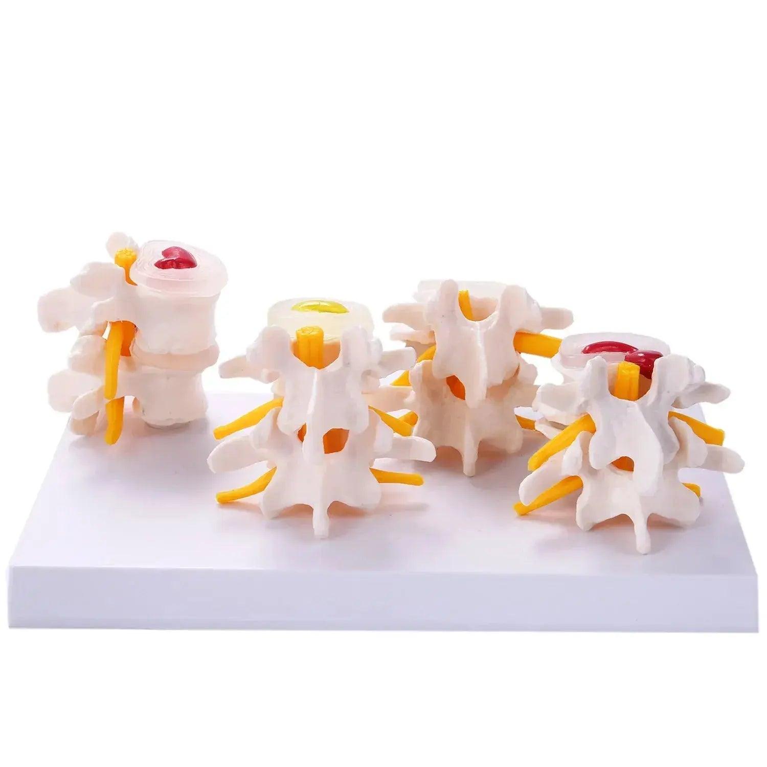  Lumbar Spine Vertebrae Model Two Part Anatomy Education -  ToylandEU™