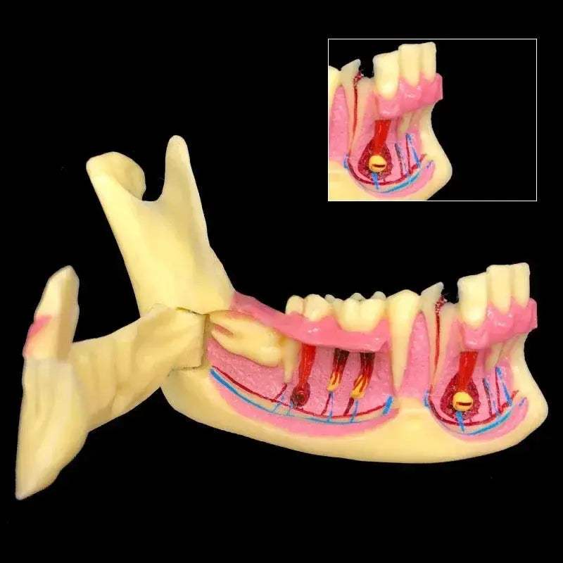 Mandibular Decomposing Model With Open Lower Gingival For Dental Teaching - ToylandEU