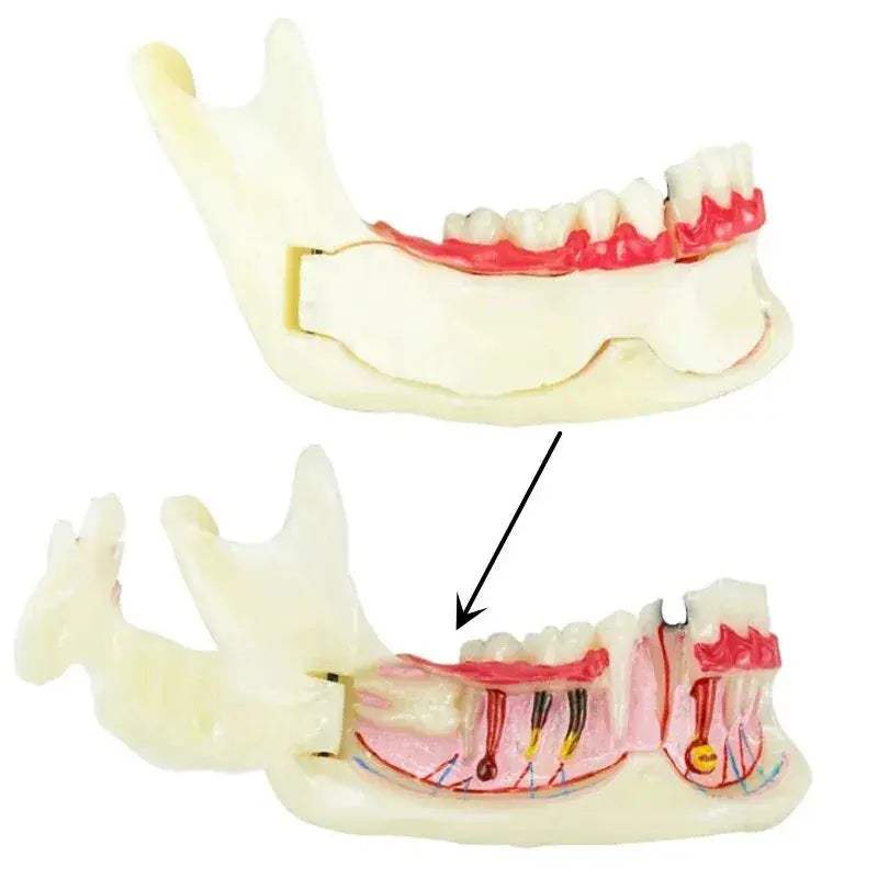 Mandibular Decomposing Model With Open Lower Gingival For Dental Teaching - ToylandEU