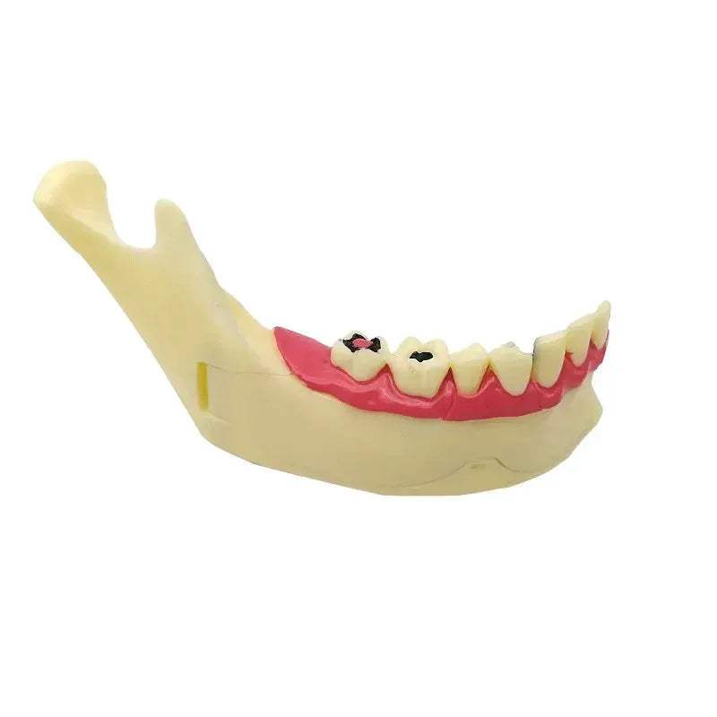 Mandibular Decomposing Model With Open Lower Gingival For Dental Teaching - ToylandEU