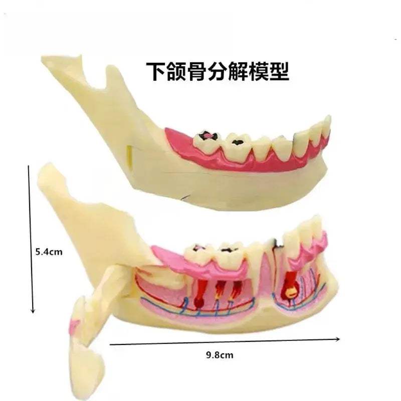 Mandibular Decomposing Model With Open Lower Gingival For Dental Teaching - ToylandEU