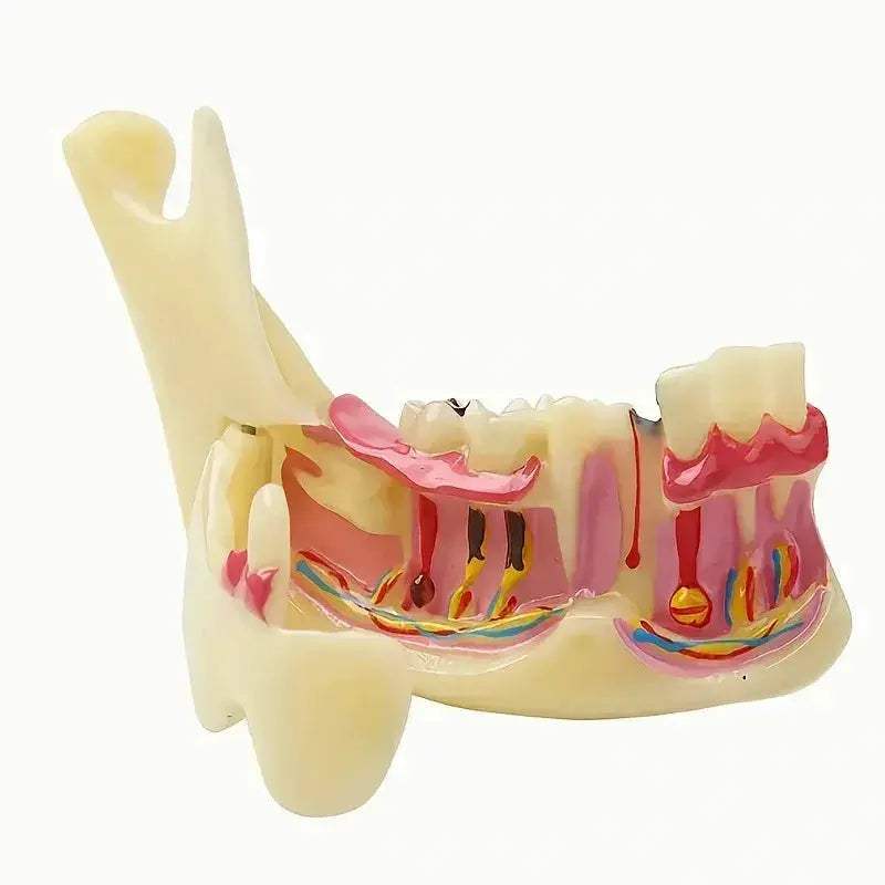 Mandibular Decomposing Model With Open Lower Gingival For Dental Teaching - ToylandEU