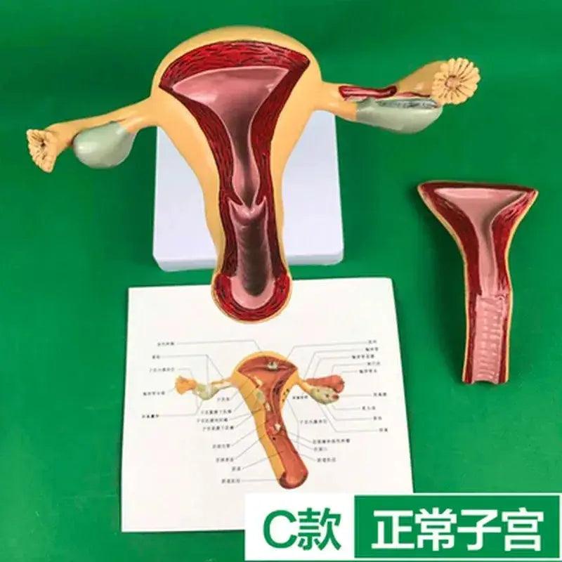  Ovary Uterus Pathology Dissection Model 1to1 Scale -  ToylandEU™