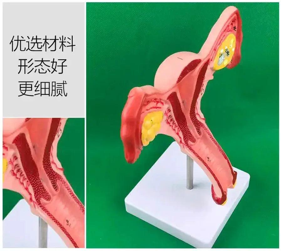  Ovary Uterus Pathology Dissection Model 1to1 Scale -  ToylandEU™