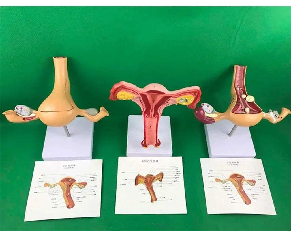 Ovary Uterus Pathology Dissection Model for Medical Education - ToylandEU
