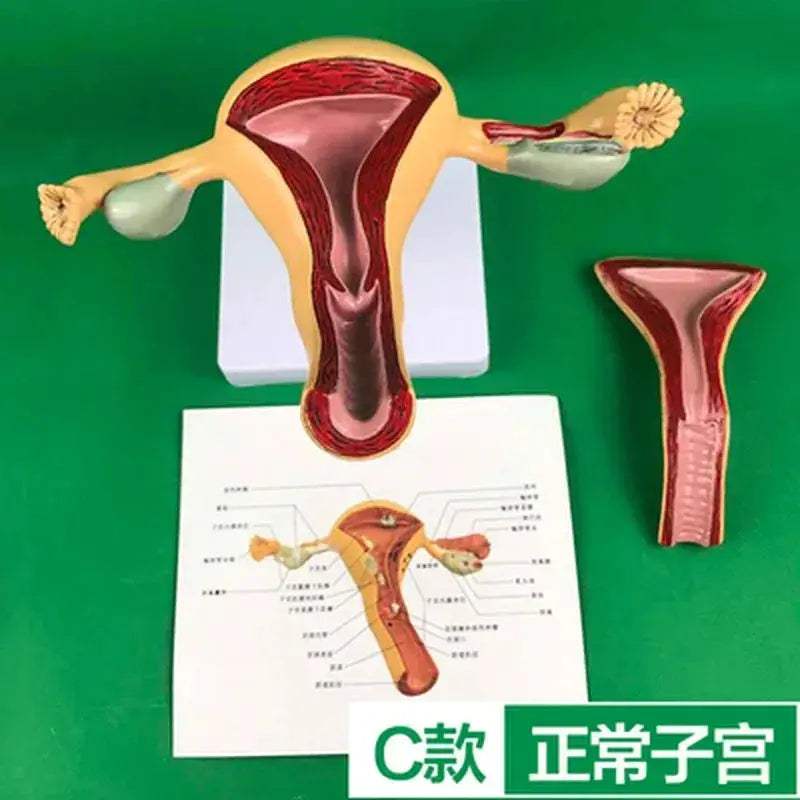 Ovary Uterus Pathology Dissection Model for Medical Education - ToylandEU