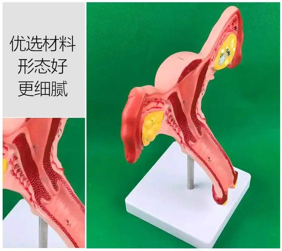 Ovary Uterus Pathology Dissection Model for Medical Education - ToylandEU