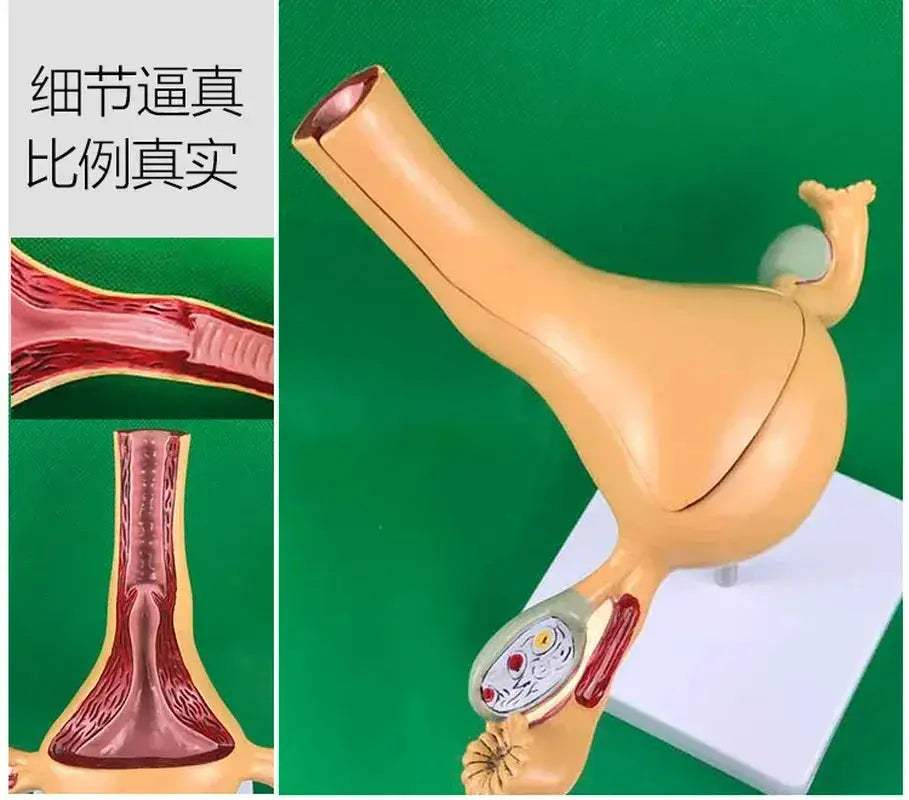 Ovary Uterus Pathology Dissection Model for Medical Education - ToylandEU