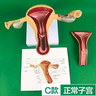 Ovary Uterus Pathology Dissection Model for Medical Education - ToylandEU