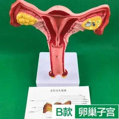 Ovary Uterus Pathology Dissection Model for Medical Education - ToylandEU
