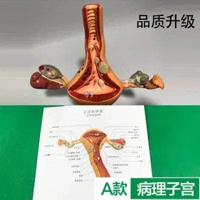 Ovary Uterus Pathology Dissection Model for Medical Education - ToylandEU