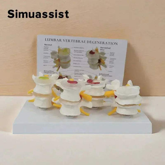  Pathological Lumbar Spine Anatomy Model For Teaching -  ToylandEU™