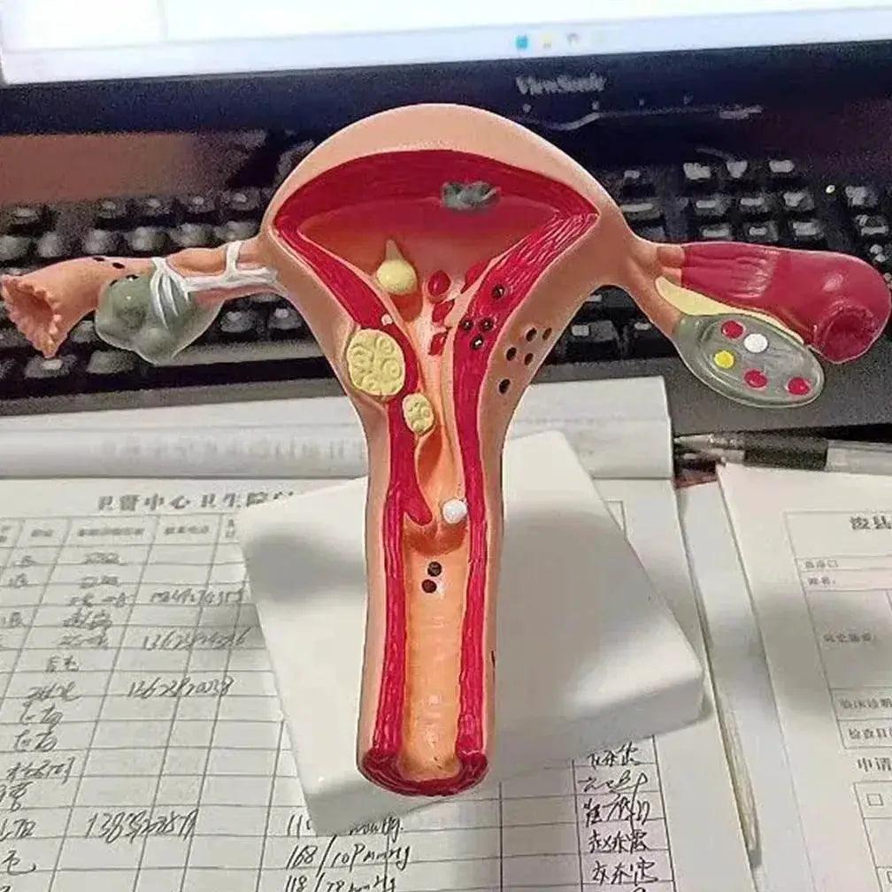  Cross Section Structure Model Human Pathological Uterus Ovary Model Uterus Anatomical Anatomy Female Organ Teaching Study Tool -  ToylandEU™